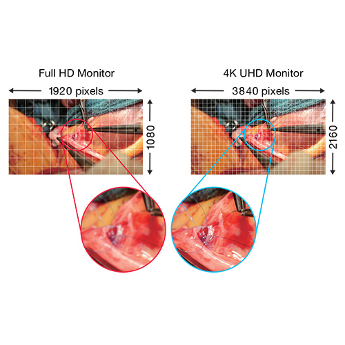 4K SURGIAL AND DIAGNOSTIC MONITOR