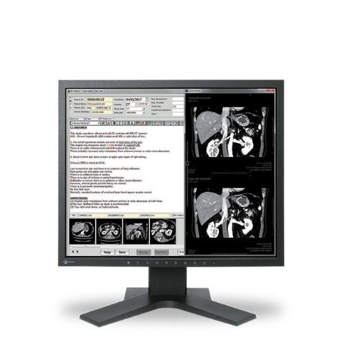 EIZO RADIFORCE MX194-BK 19IN 1MP CLINICAL REVIEW MONITOR