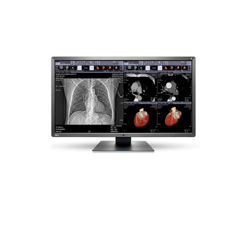EIZO RADIFORCE MX315W 31″ 8MP COLOR LCD DIAGNOSTIC MONITOR