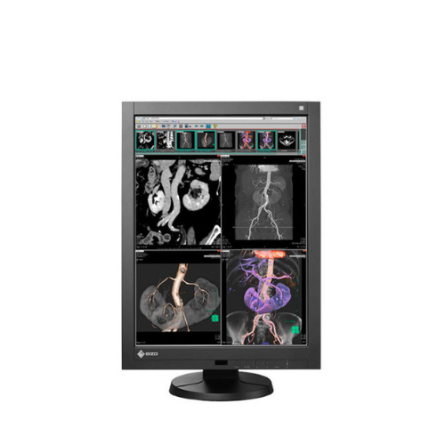 EIZO RADIFORCE RX340 (RX340-BK) 21″ 3MP COLOR DIAGNOSTIC MONITOR