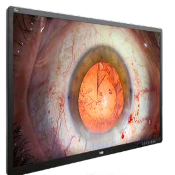WIDE 55 4K 3D Medical Grade Monitor Phoenix Medikal