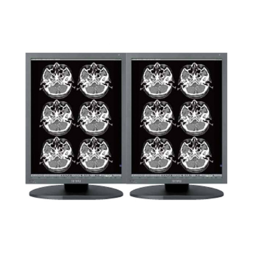 TOTOKU 2MP MS25I2 DUAL HEAD GRAYSCALE DIAGNOSTIC MONITOR