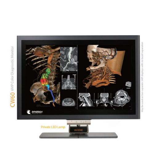 WIDE CW60 6MP COLOR DIAGNOSTIC MONITOR